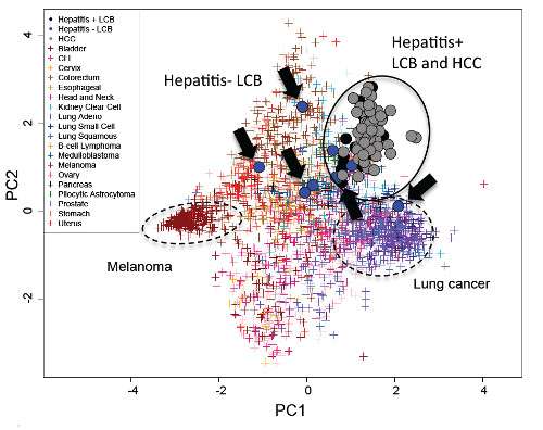Hot on the trail of the hepatitis-liver cancer connection