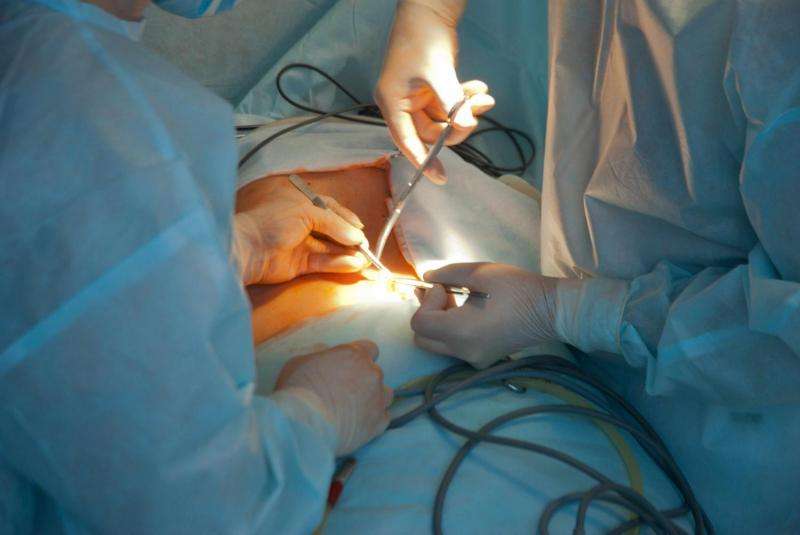 How does human behavior lead to surgical errors? Mayo Clinic researchers count the ways