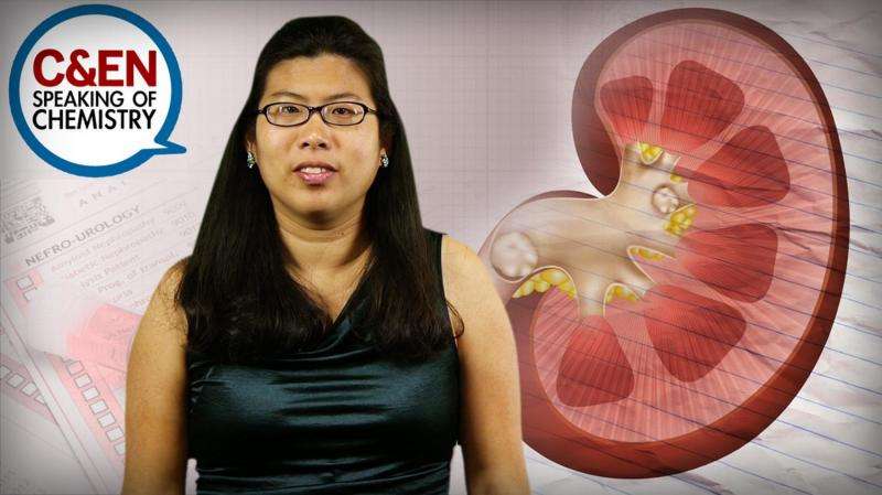 How to avoid kidney stones (video)