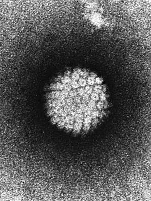 human papillomavirus