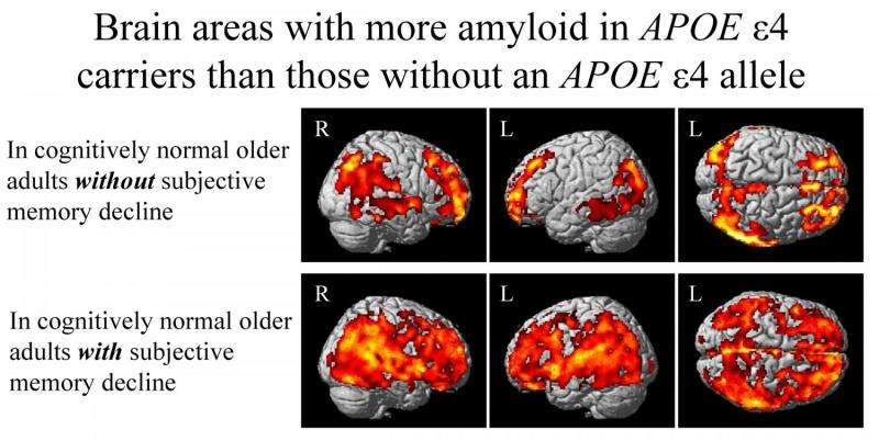 Impact of major Alzheimer's-related gene may be felt years before any symptoms appear