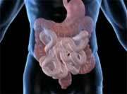 Infliximab lost into feces of patients with ulcerative colitis