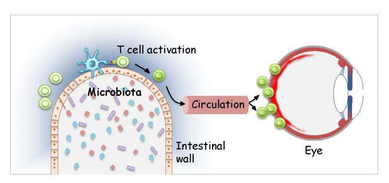 在葡萄膜炎中，肠道细菌可以指示免疫细胞攻击眼睛