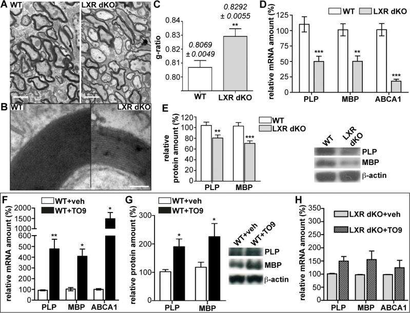 Invalidation or activation of LXRs alters myelin structure and myelin gene expression in the cerebellum