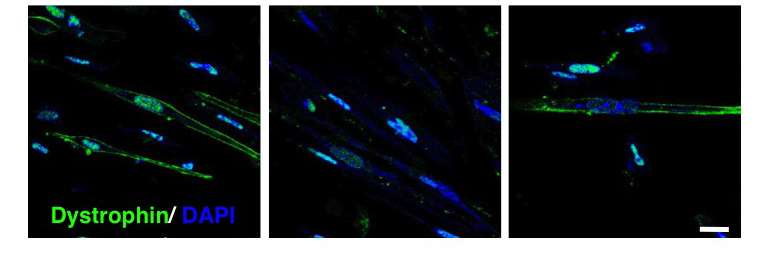 iPS cells discover drug target for muscle disease