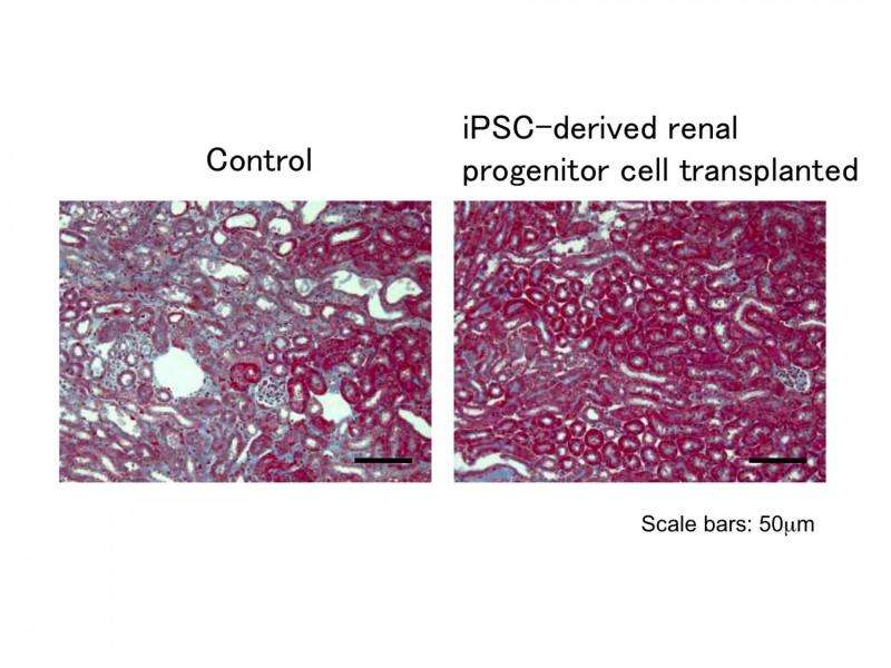iPSCs show promise for kidney treatment