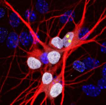 Jammed up cellular highways may initiate dementia and ALS