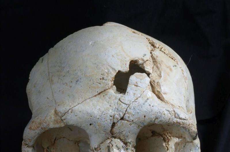 Lethal wounds on skull may indicate 430,000-year-old murder