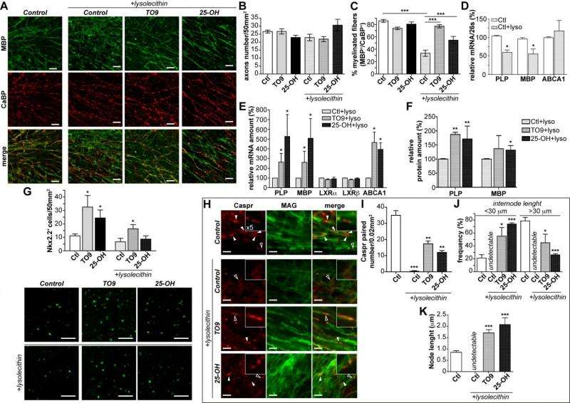 LXR activation accelerates remyelination in organotypic cerebellar cultures