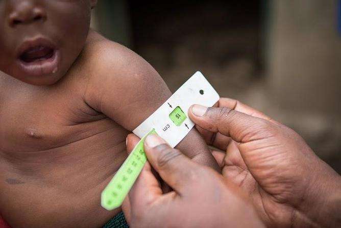 Malnutrition, stunting and the importance of a child’s first 1000 days