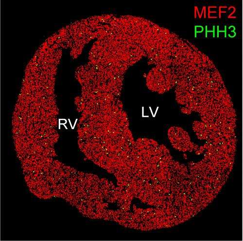 Mammalian heart regenerative capacity depends on severity of injury