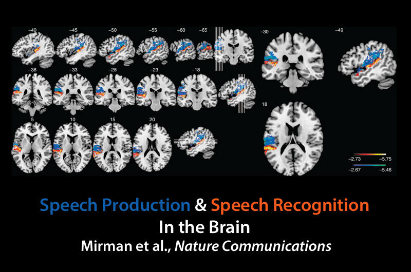 Mapping language in the brain