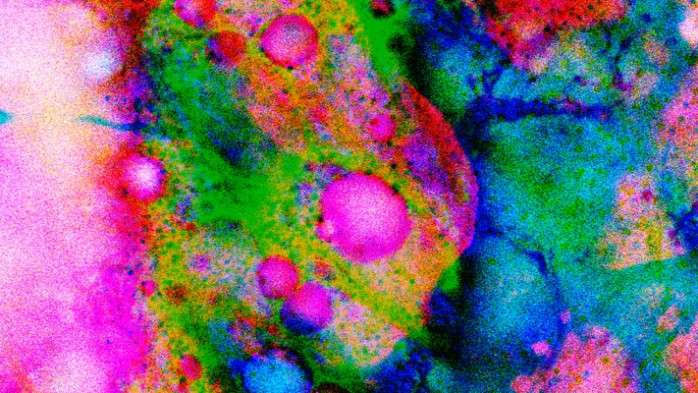MARCKS Protein May Help Protect Brain Cells from Age Damage