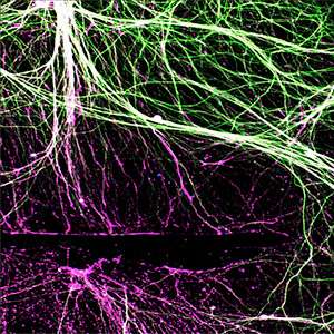 Master gene orchestrates regeneration of damaged peripheral nerves​