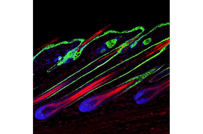 MicroRNAs contribute to hair loss and follicle regression