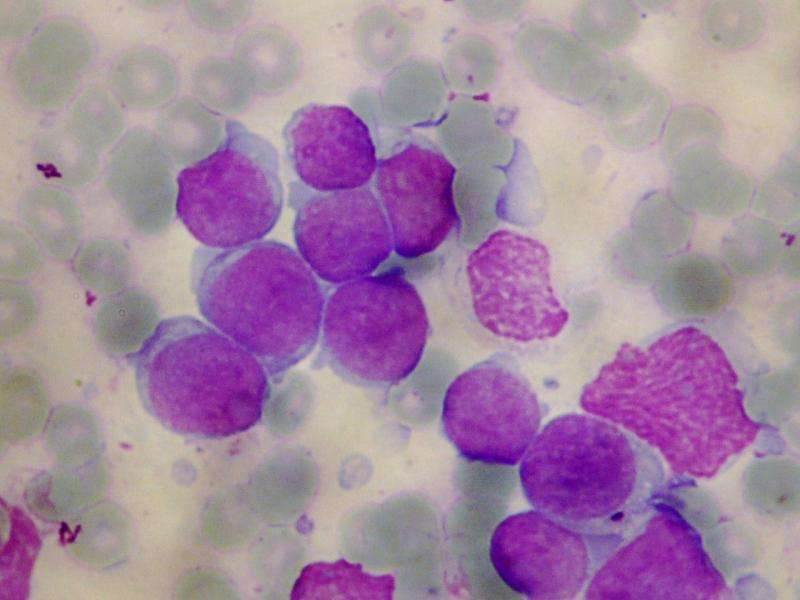 仅微小残留疾病不能预测t细胞白血病