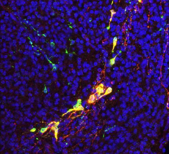 A molecule important in blood vessel formation, brain wiring is also ...