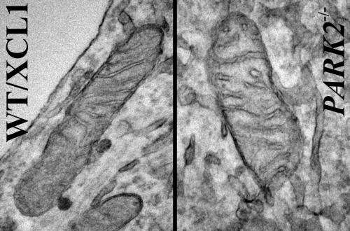 Mitochondria are altered in human cell model of Parkinson's disease