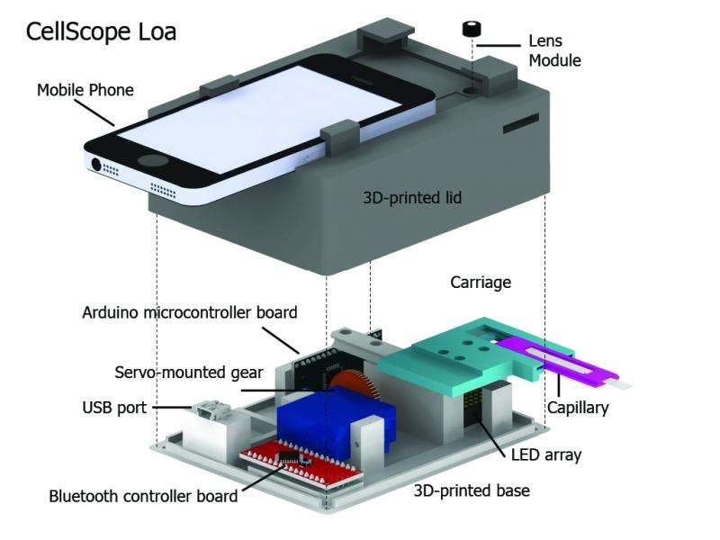 Mobile phone video microscope automates detection of parasites in blood