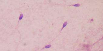 More sperm cells may be needed to overcome high mortality rate