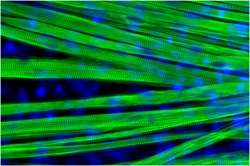 Muscle fibers grown in the lab offer new model for studying muscular dystrophy