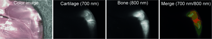 Near-infrared imaging techniques for cartilage tissue