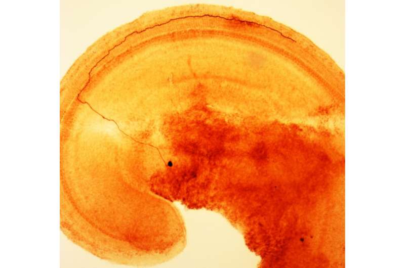 Nerve cells warn brain of damage to the inner ear