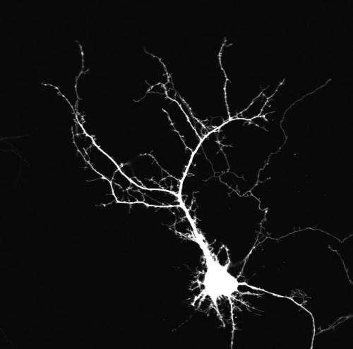neuron, dendrite