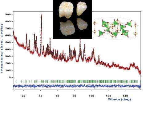 Neutron analysis of human teeth could assist in the fight against dental erosion