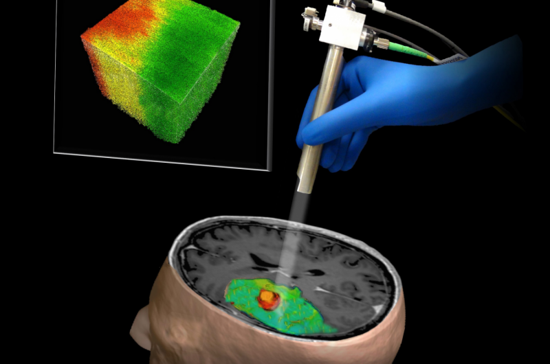 New imaging technique could make brain tumor removal safer, more effective, study suggests