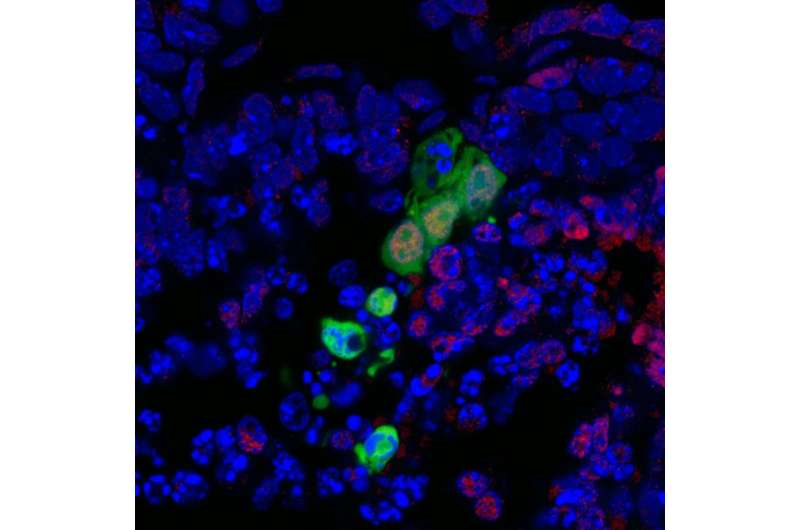 New stem cell may overcome hurdles for regenerative medicine