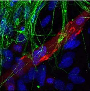 新的干细胞研究揭示了脊肌萎缩的原因