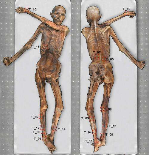 New tattoos discovered on Oetzi mummy