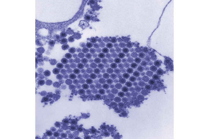 NIH-sponsored clinical trial of chikungunya vaccine opens