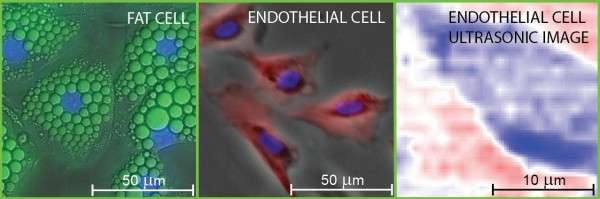 Nondestructive 3-D Imaging of Biological Cells with Sound