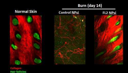 Novel nanoparticle therapy promotes wound healing