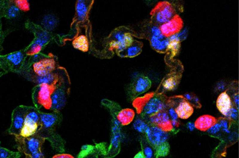 One type of airway cell can regenerate another lung cell type