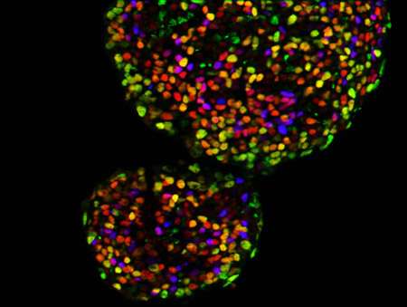 'Open' stem cell chromosomes reveal new possibilities for diabetes