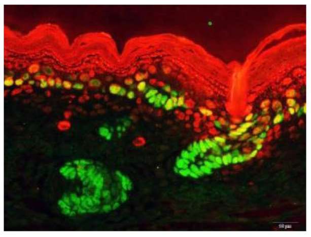 Penn study demonstrates genes' major role in skin and organ development