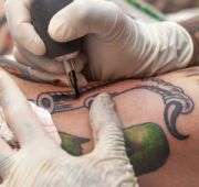 Picosecond-domain laser safe for removing decorative tattoos