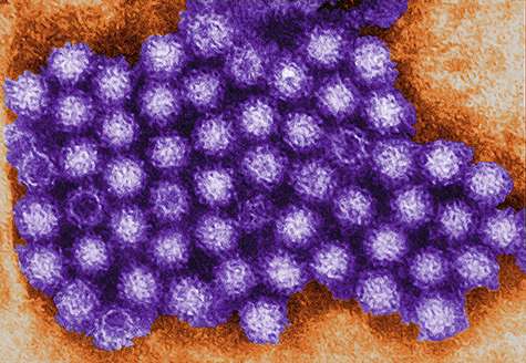 Possible treatments identified for highly contagious stomach virus