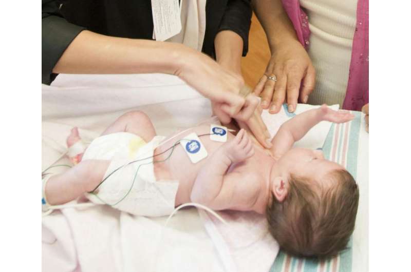 Preemies at high risk of autism don't show typical signs of disorder in early infancy