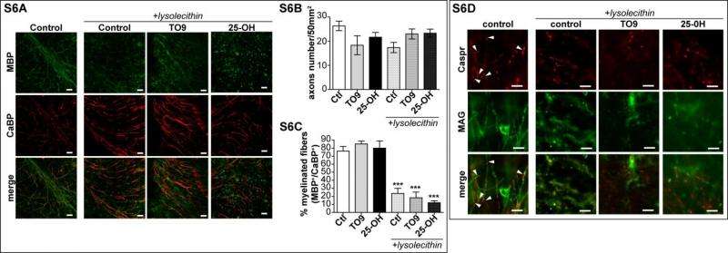 Presence of LXRs is crucial for oxysterol-induced ex vivo remyelinatio