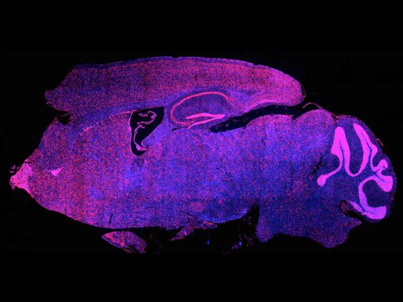 Promising class of new cancer drugs might cause memory loss in mice