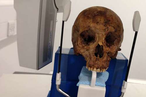 Radiography academics X-ray Victorian skeletons from Crossrail excavations