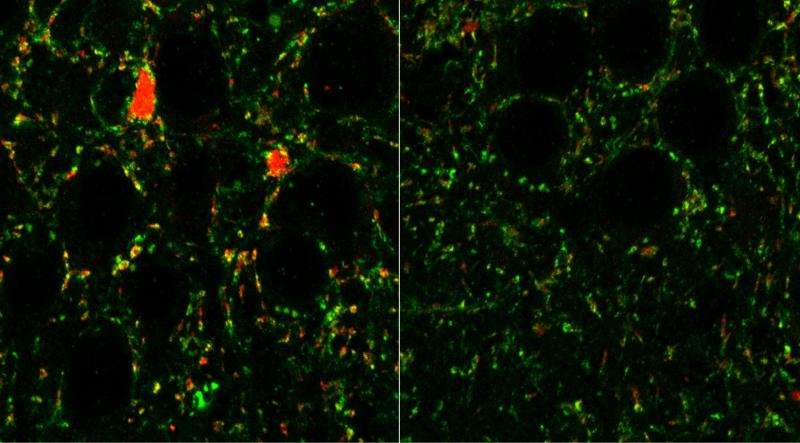 Receptors in brain linked to schizophrenia, autism