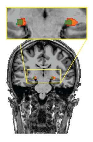 Results challenge conventional wisdom about where the brain processes visual information