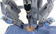 Robotic sx viable for morbidly obese with endometrial cancer