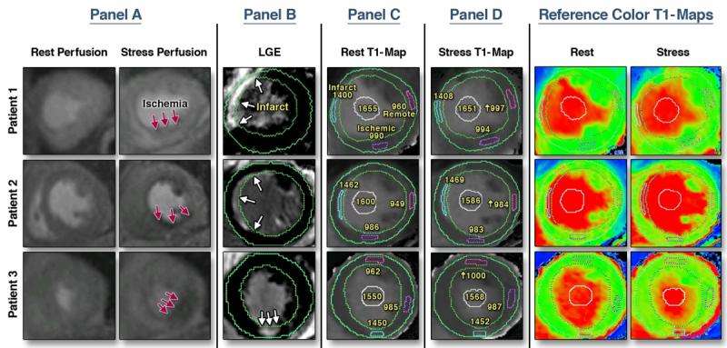 Safer, faster heart scans in view