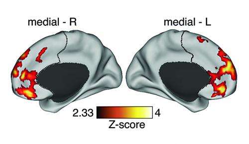 Schizophrenia onset linked to elevated neural links